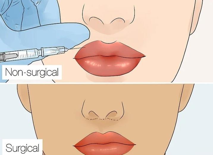 انواع فرم لب 15