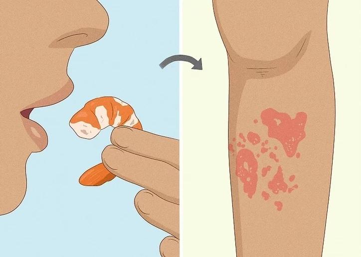 علت شایع خارش پاها  6