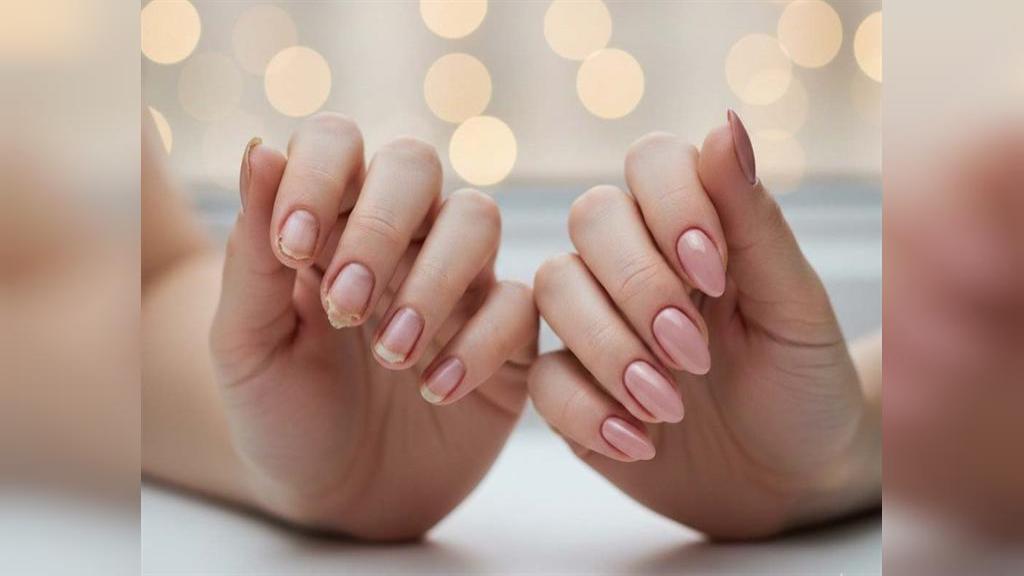 کاشت ناخن برای ناخن های ضعیف و شکننده؛ درمان یا تشدید مشکل؟