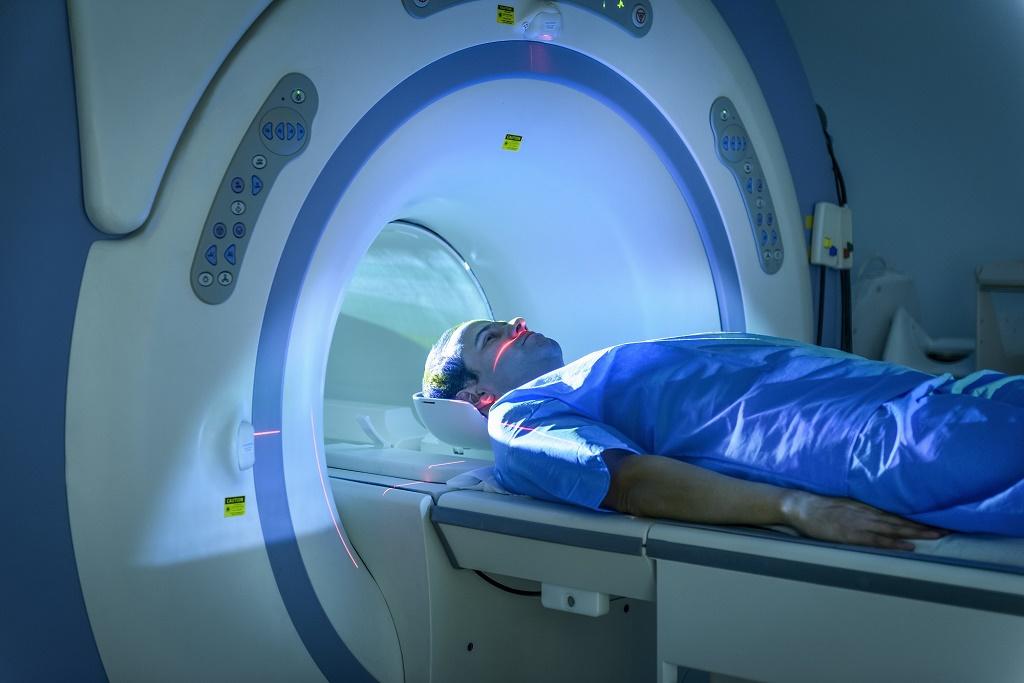 تشخیص آنوریسم مغزی - MRI