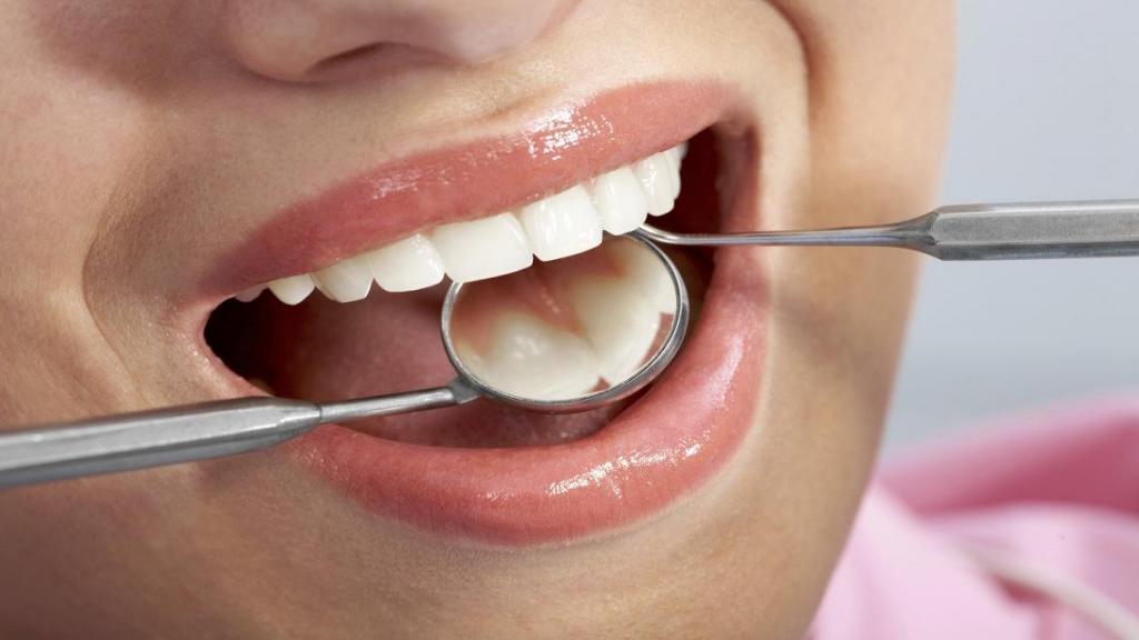 جلوگیری و درمان پوسیدگی دندان با 12 روش خانگی و پزشکی