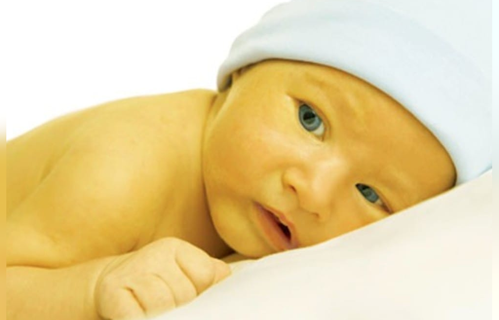 علل زردی در نوزادان چیست؟ 
