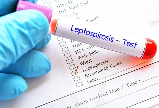چه آزمایشاتی برای تشخیص لپتوسپیروز انجام می شود؟