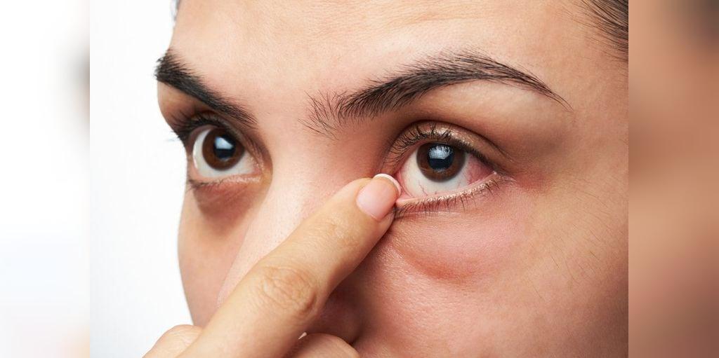 چه عواملی باعث پرش چشم یا تیک چشم می شود؟