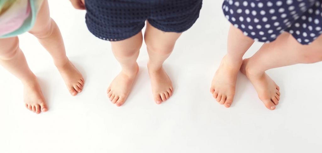 صافی کف پاها در کودکان