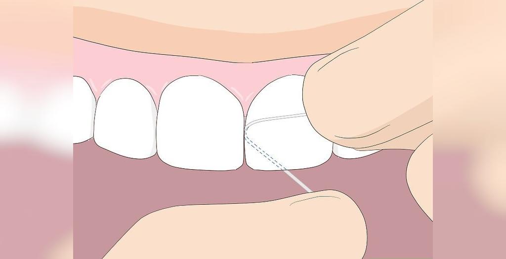 نحوه صحیح کشیدن نخ دندان در کودکان