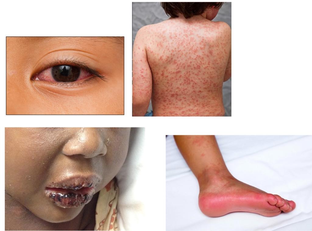 عوامل سکته قلبی در نوجونان 2