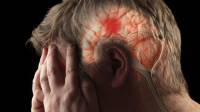 علائم سکته مغزی چیست؛ علت، تشخیص، عوارض و درمان سکته مغزی