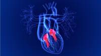 علائم مشکل دریچه قلب چیست؛ علت و درمان بیماری دریچه قلب