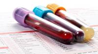 لیست آزمایش چکاپ کامل خون ضروری که هر سال باید انجام دهید