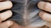 برای جلوگیری از سفید شدن مو چی بخوریم + راه های خانگی و طبیعی