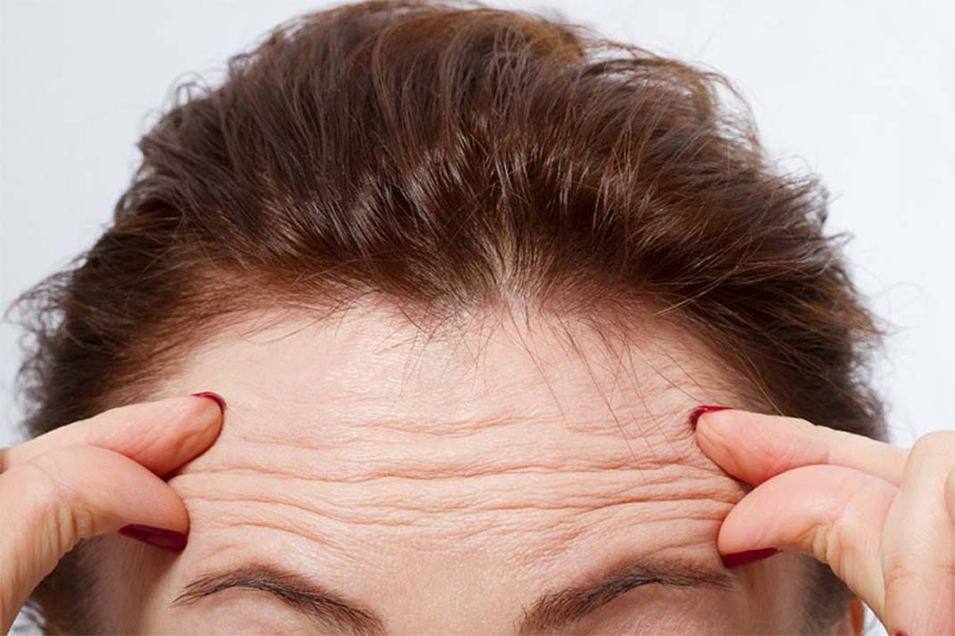 تعبیر خواب پیشانی چیست؟